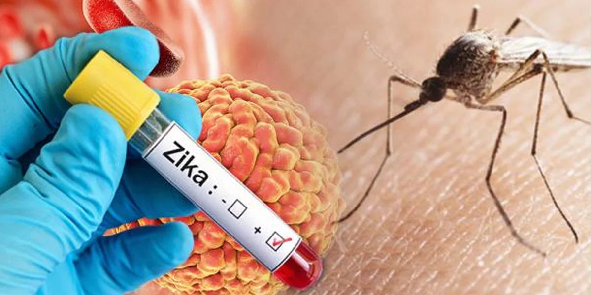 Zika virus is accelerating in Pune.. The spread of infection to pregnant women.!  Full details..-oneindia news